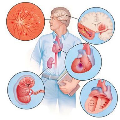 Cardiol evita o desenvolvemento de enfermidades concomitantes